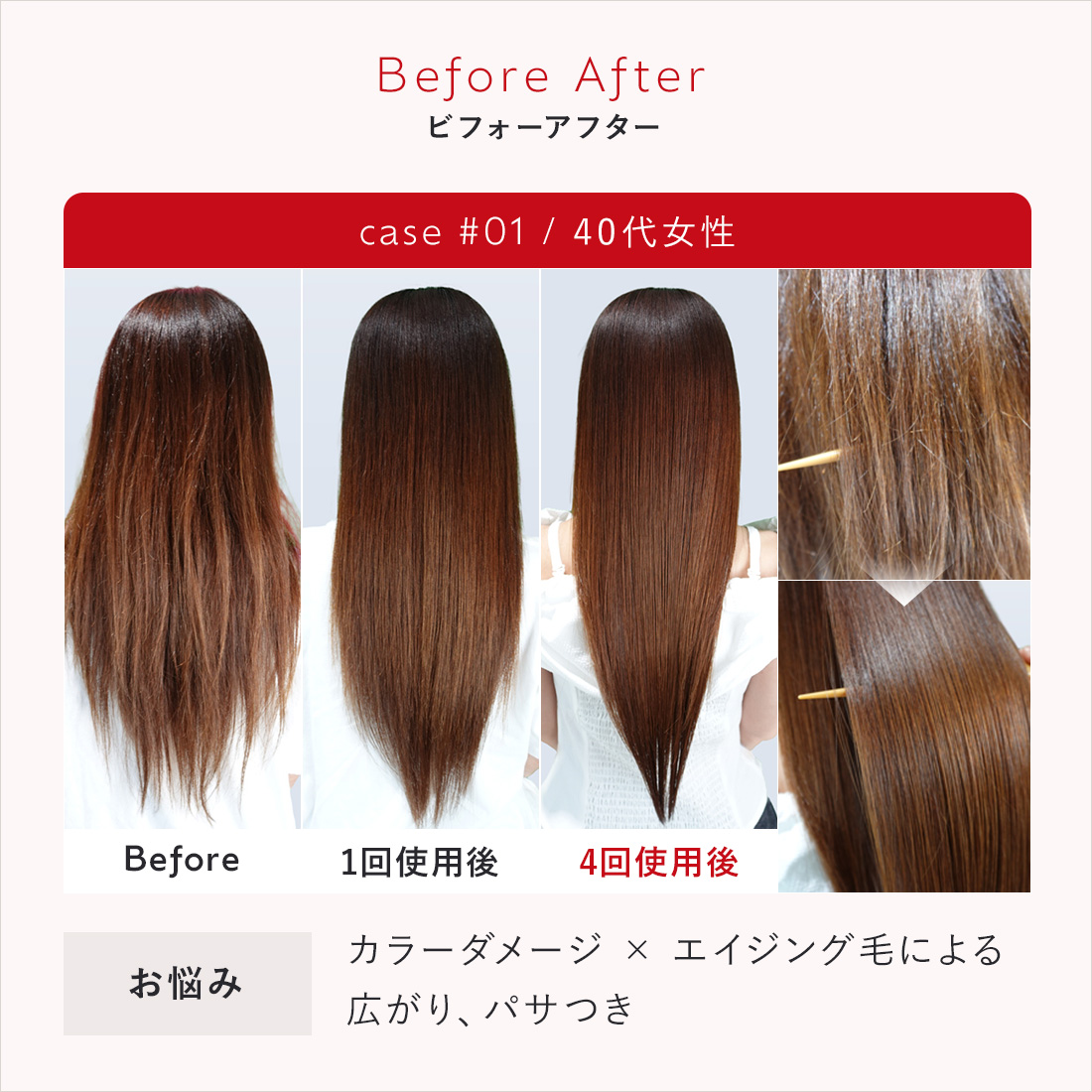 【定期】ウィークリーシステムトリートメント_週1ケアコース