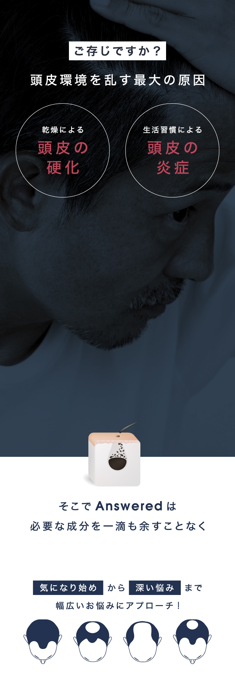 頭皮環境を乱す最大の原因