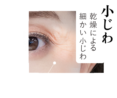 【小じわ】乾燥による細かい小じわ