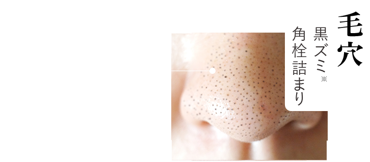 【毛穴】黒ズミ角栓詰まり