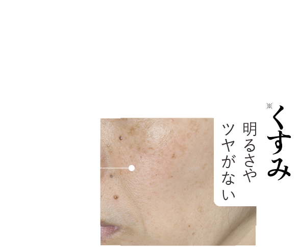 【くすみ】明るさやツヤがない