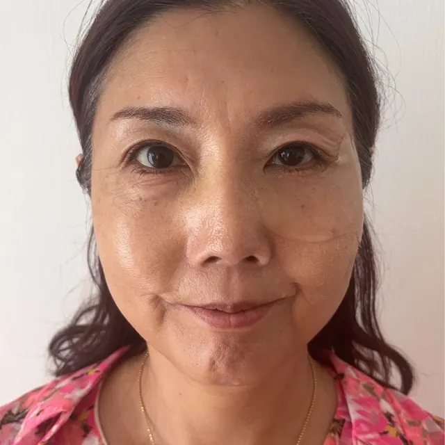 BEETOXを使っている50代の方の笑顔
