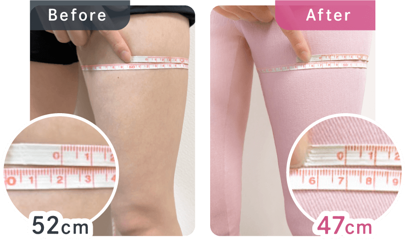着圧ツイルパンツ着用後、太ももが-4.5cmになっている写真