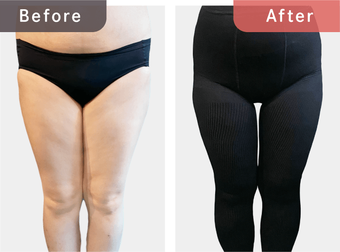 プレーン着圧レギンスの着用前後の比較写真