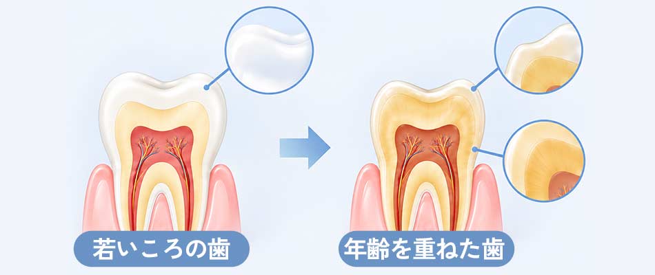 加齢などによる変色