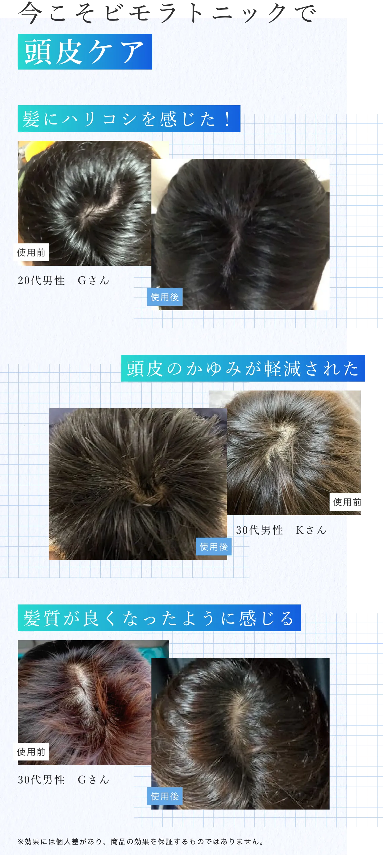 今こそビモラトニックで頭皮ケア