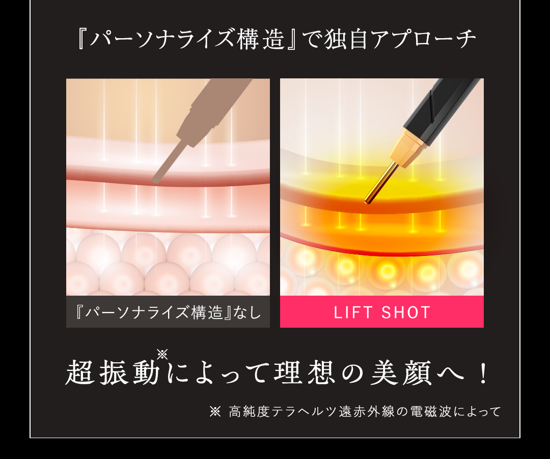 liftshot