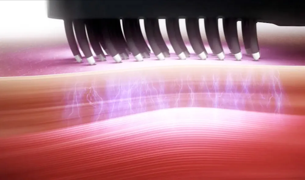 公式】ELEKI BRUSH PLUS