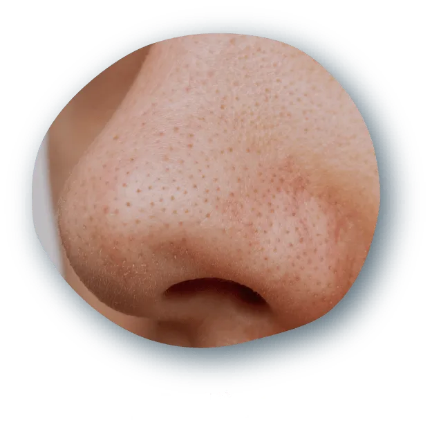 毛穴1