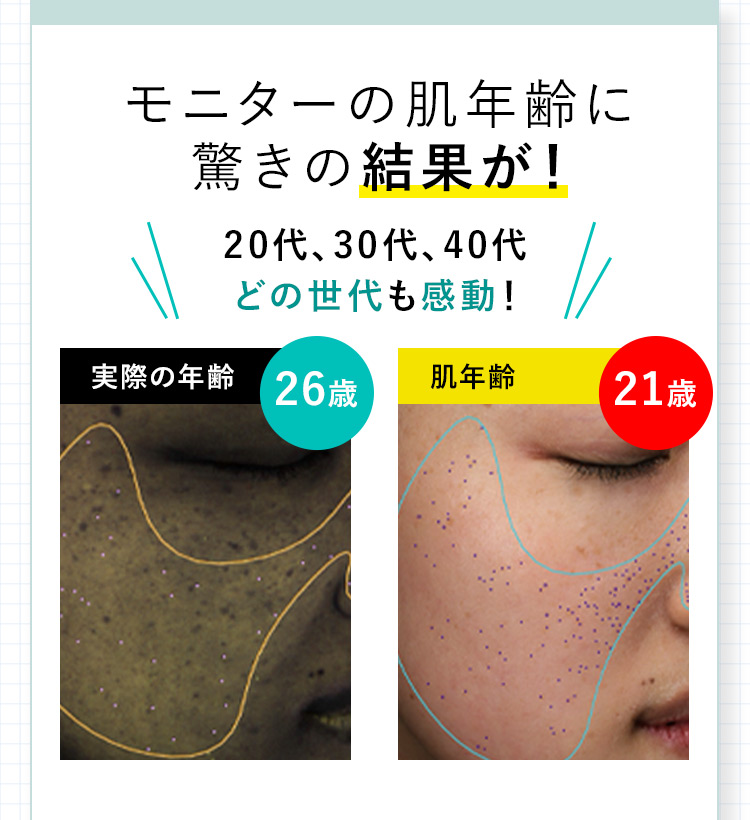 モニターの肌年齢に驚きの結果が！ 20代、30代、40代 どの世代も感動！ 実際の年齢 26歳 肌年齢 21歳