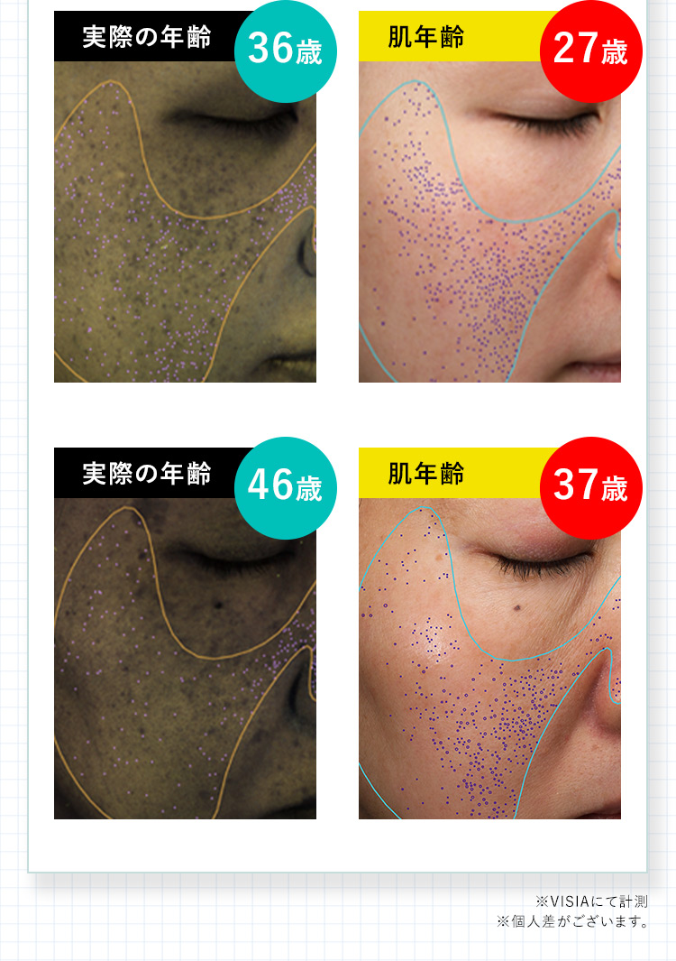 実際の年齢 36歳 肌年齢 27歳 実際の年齢 46歳 肌年齢 37歳 ※VISIAにて計測 ※個人差がございます。