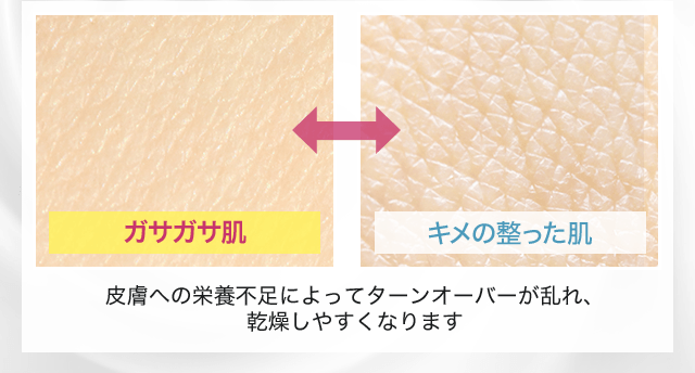 皮膚への栄養不足によってターンオーバーが乱れ、乾燥しやすくなります。