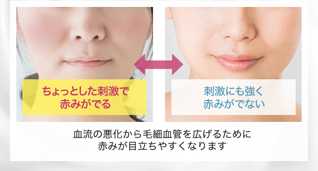 血流の悪化から毛細血管を広げるために赤みが目立たなくなります