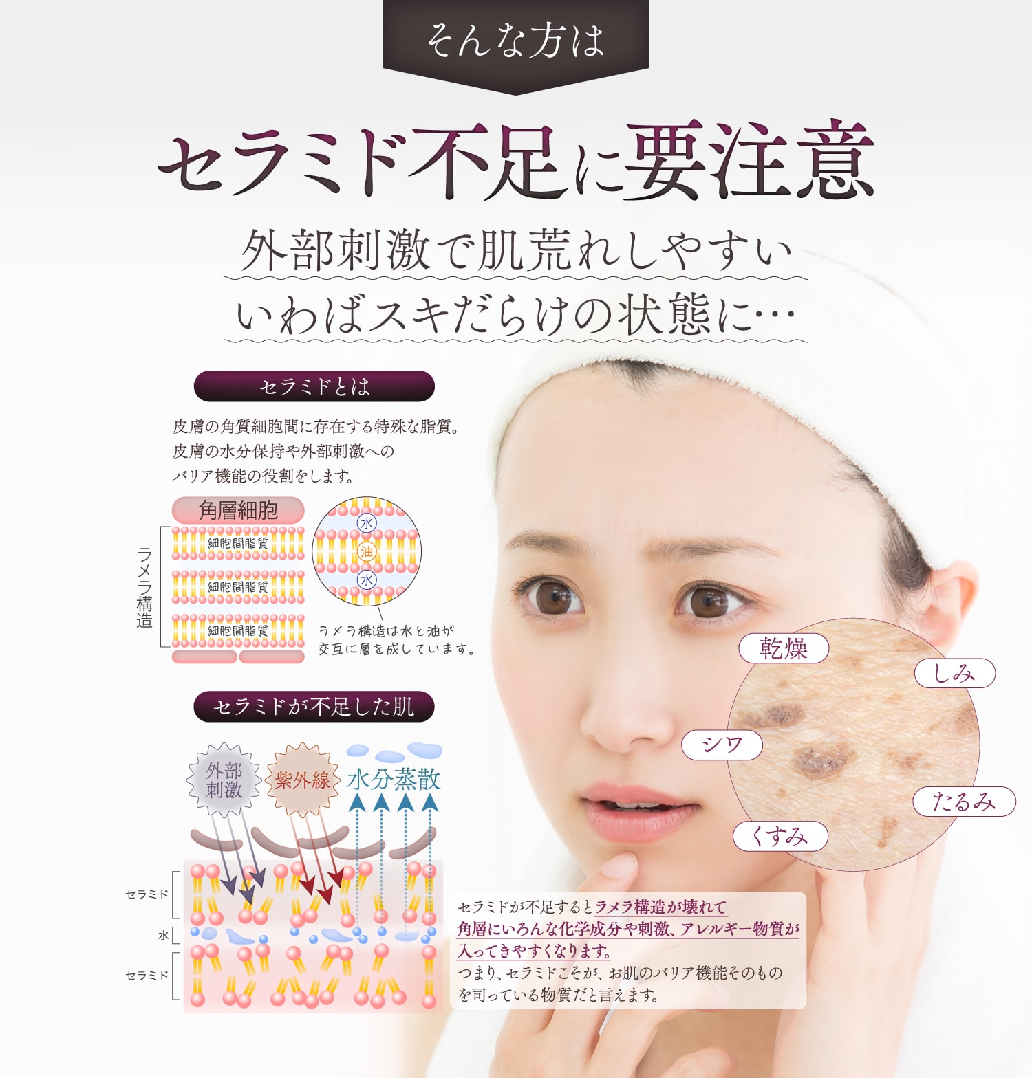 セラミド不足に要注意