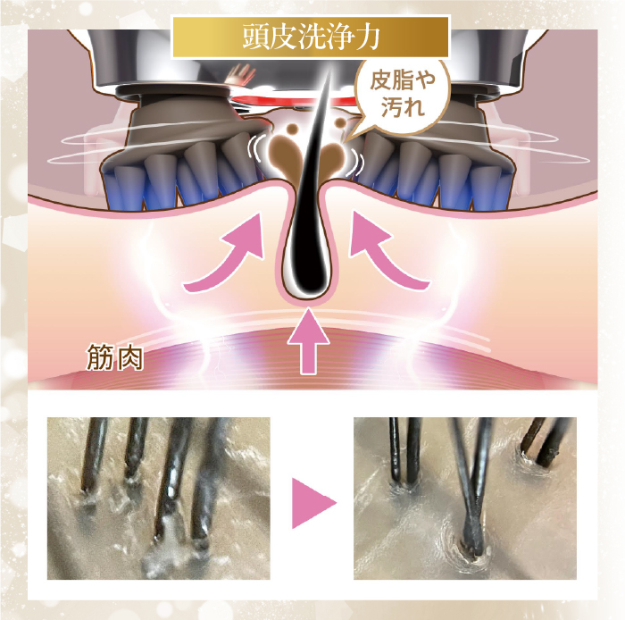 【９月限定】頭皮スパ｜7,040円相当美容液付き
