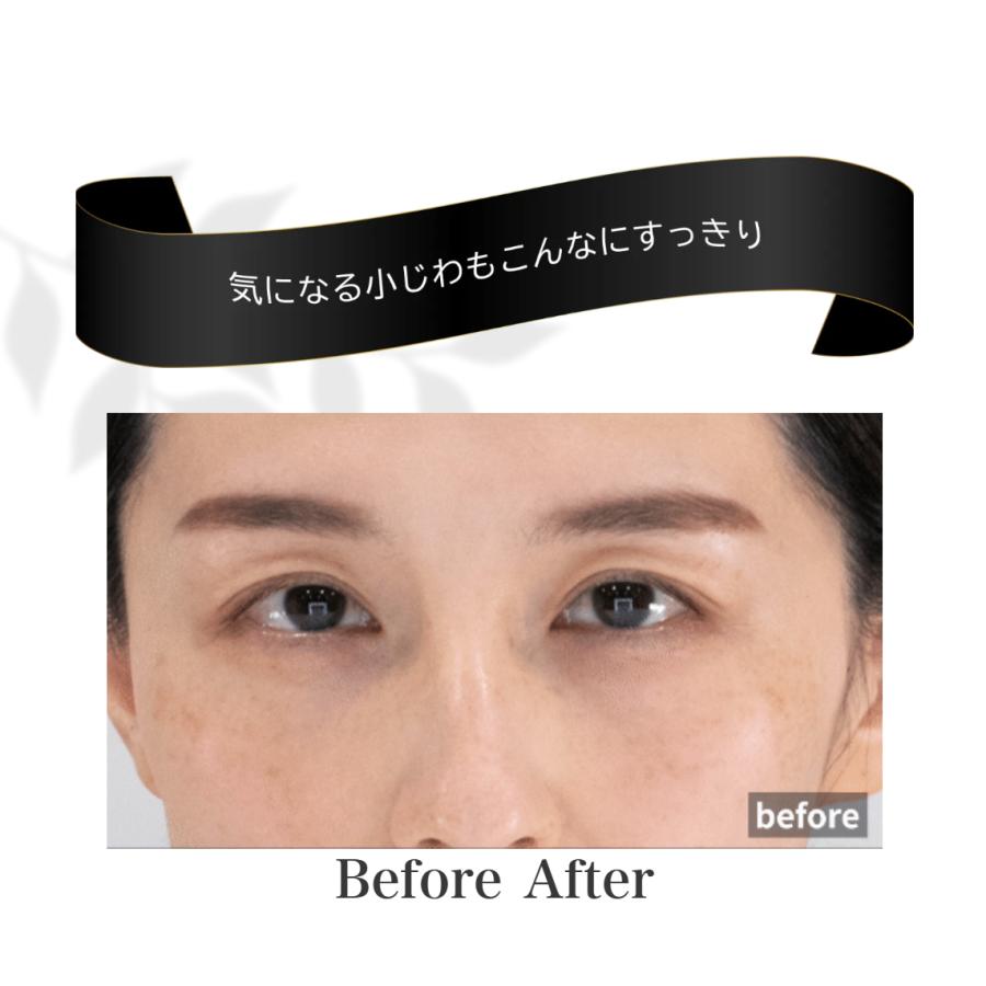 R;BATON(アールバトン) カラー: 001 普通肌