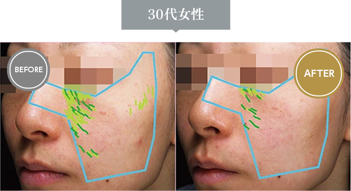 30代女性