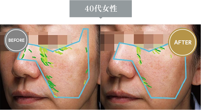 40代女性