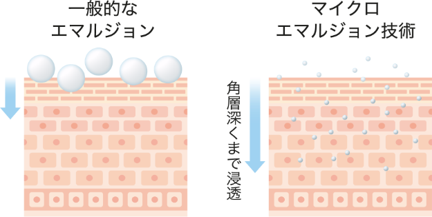 グローブーストシリーズ