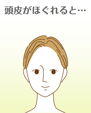頭皮がほぐれると...