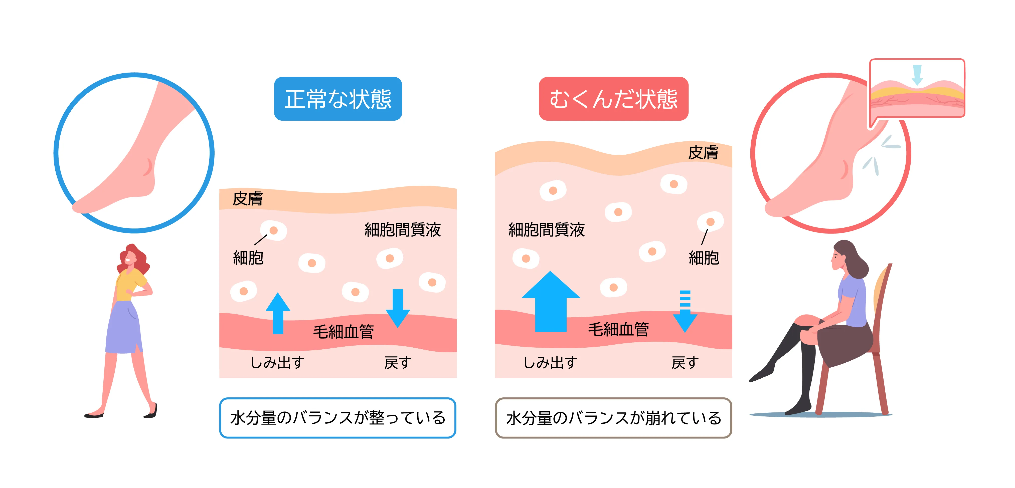 むくみの仕組み