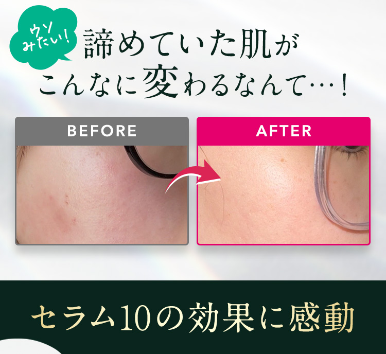 「ウソみたい！」諦めていた肌がこんなに変わるなんて…！セラム10の効果に感動