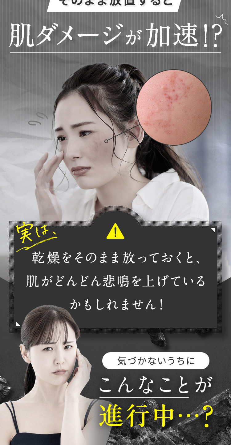 そのまま放置すると、肌ダメージが加速！？実は乾燥をそのまま放っておくと、肌がどんどん悲鳴を上げているかもしれません！気づかないうちにこんなことが進行中？