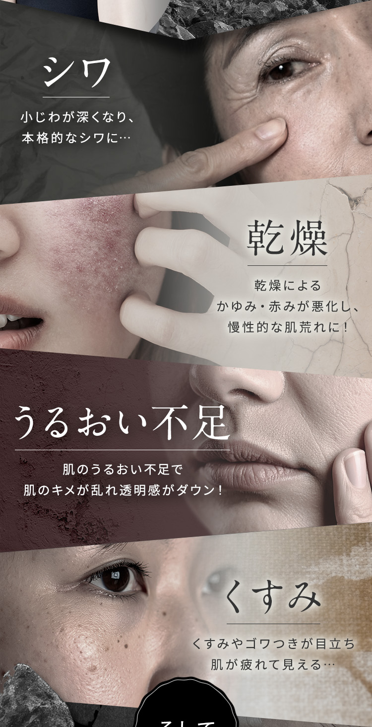 【シワ】小じわが深くなり、本格的なシワに【乾燥】乾燥によるかゆみ・赤みが悪化し、慢性的な肌荒れに！【うるおい不足】肌のうるおい不足で、肌のキメが乱れ透明感がダウン！【くすみ】】くすみやゴワつきが目立ち、肌が疲れて見える