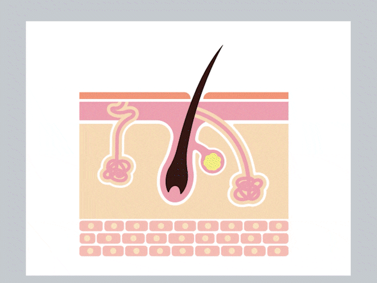 ワキガクリーム