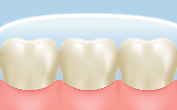 DENNOVATE - ディノベート - TEETH WHITENING GEL PACK ホワイトニング