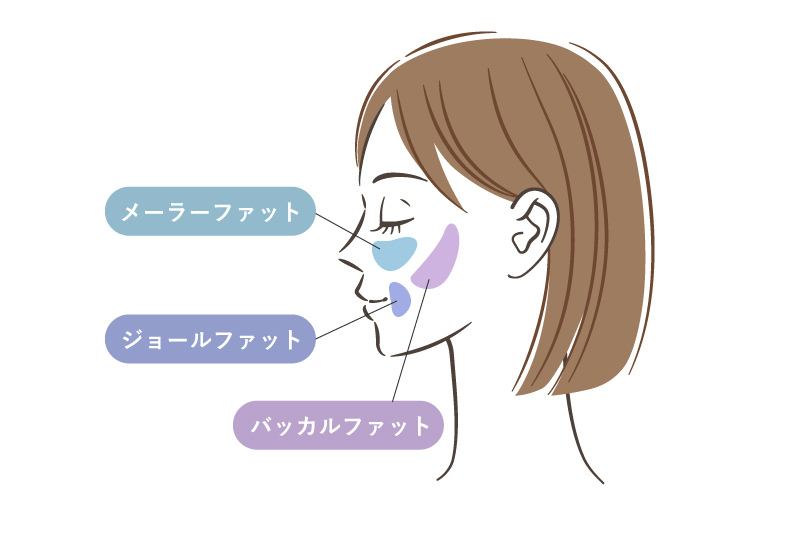 頬の脂肪（メーラーファット・バッカルファット・ジョールファット）がほうれい線に与える影響