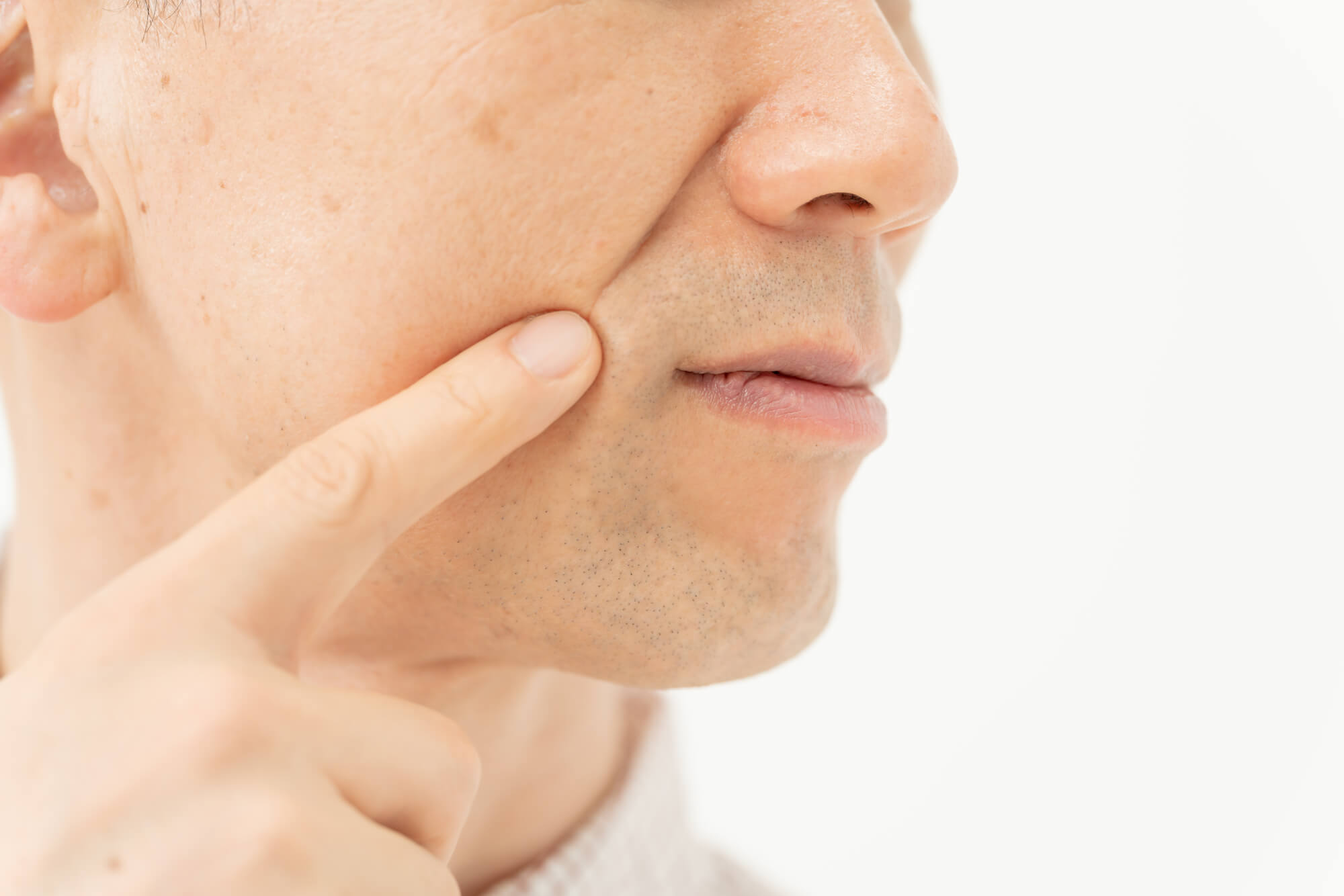 ほうれい線とは？男性に多い原因を解説