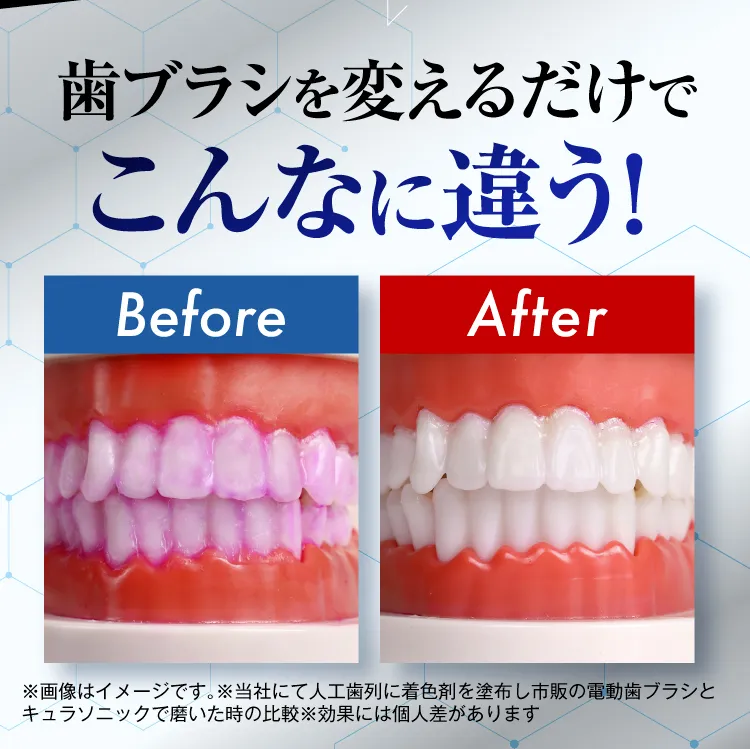 電動歯ブラシ