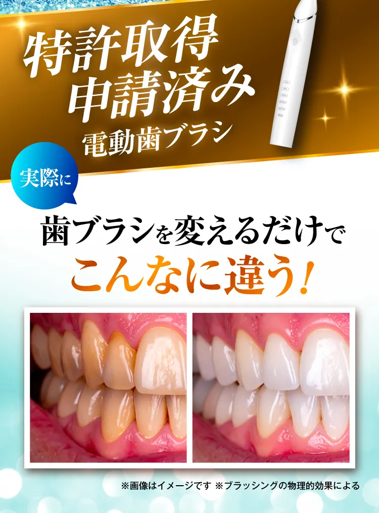 電動歯ブラシ