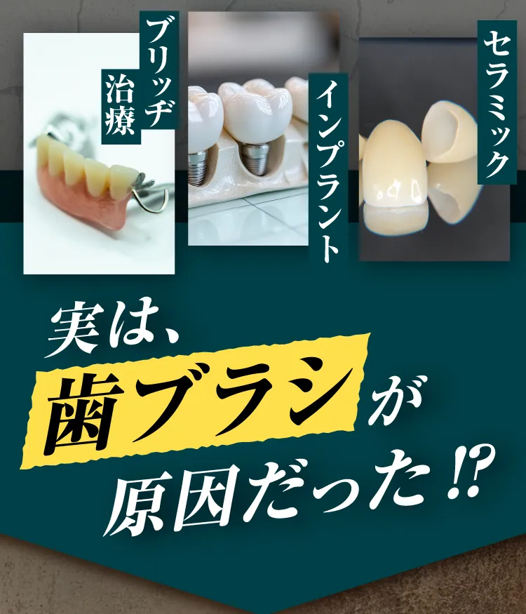 電動歯ブラシ