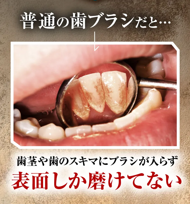 電動歯ブラシ