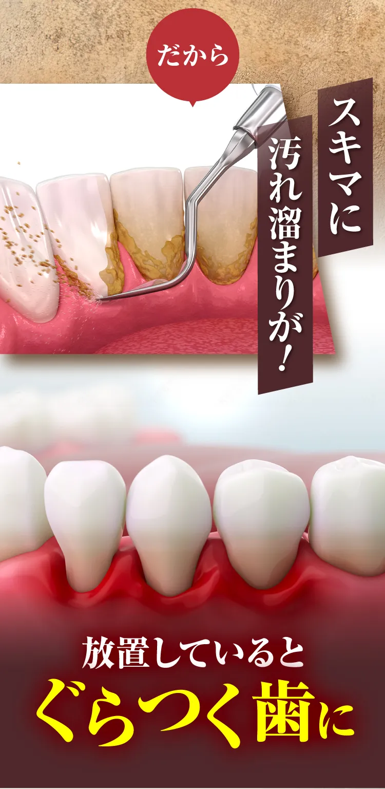 電動歯ブラシ