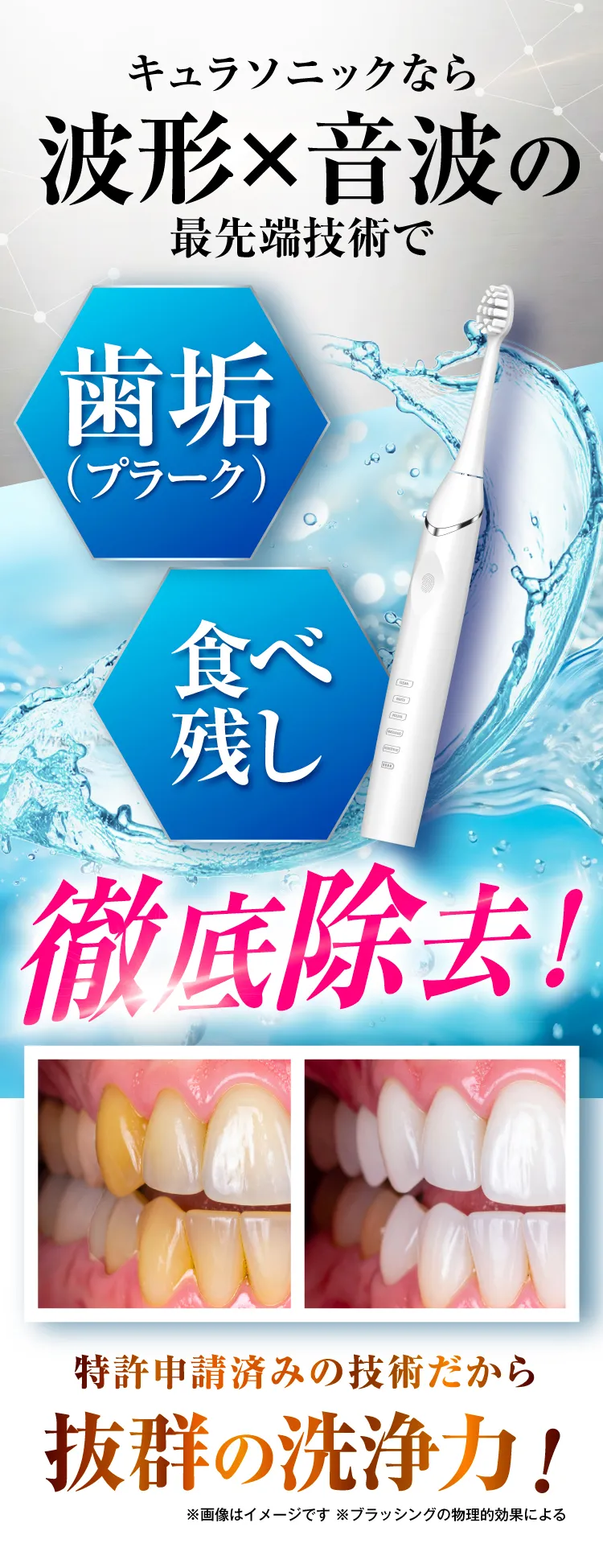 電動歯ブラシ