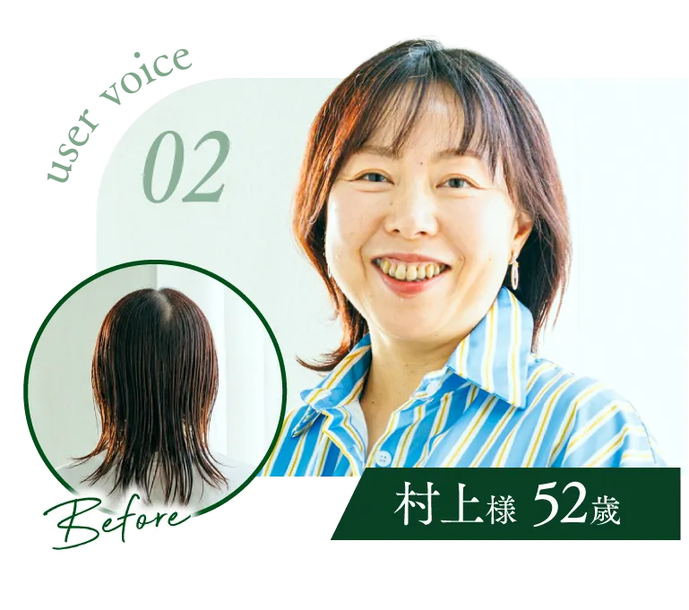 user voice 02