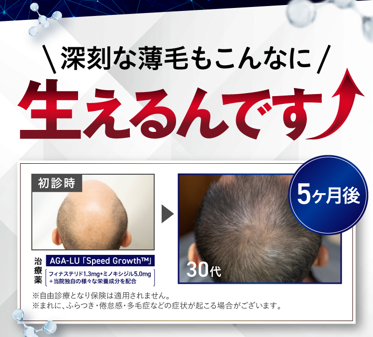 こんなに生えるんです