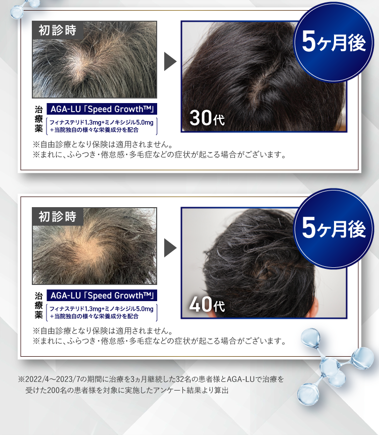 薄毛改善のビフォーアフター写真