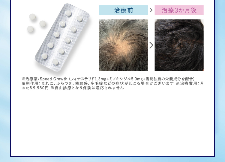 パントガード1500円送料無料の案内