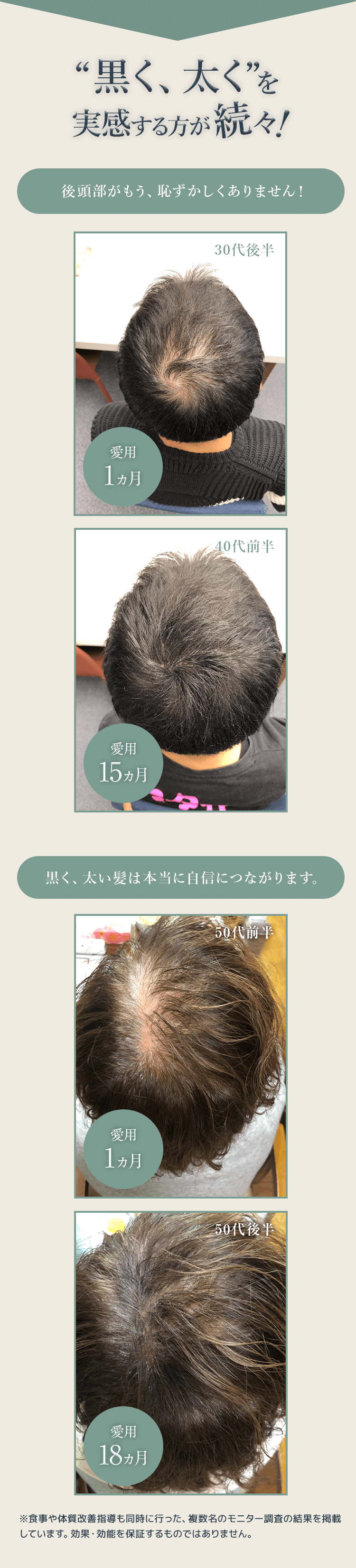 ビフォーアフター