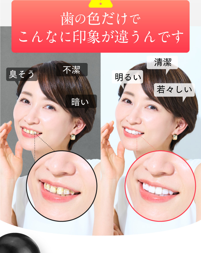 ホワイトニング歯磨き粉ホコロ