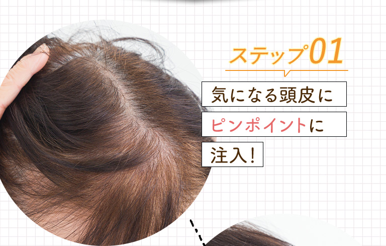 ステップ01　気になる頭皮にピンポイントに注入！