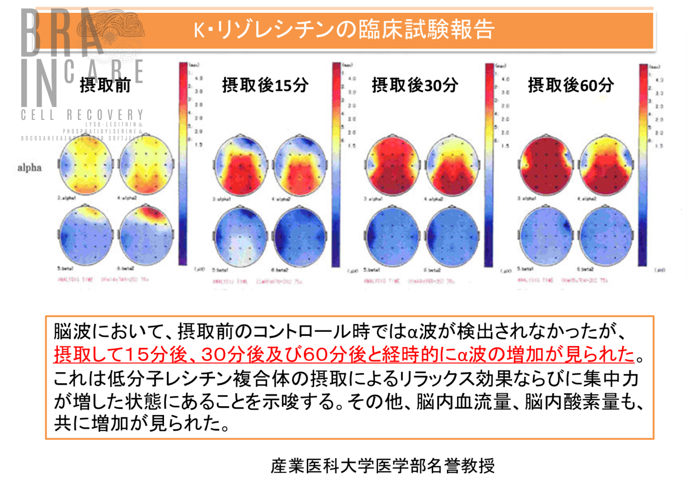 時短脳サプリ  【Brain Care 〈ブレイン ケア〉】 ※ついに発売！ 「あなたの脳に、最高の休息と、極上の栄養を」  生ゼリーで続けやすさ抜群！　