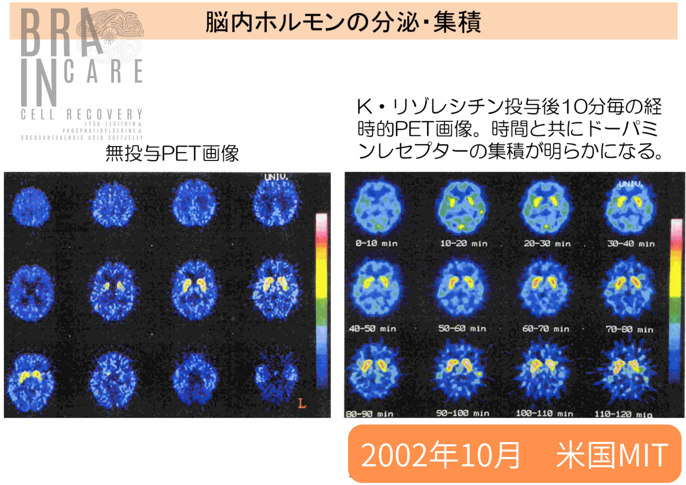 新※メンタル調整サプリ  【Brain Care 〈ブレイン ケア〉】 ※ついに発売！ 「あなたの脳に、最高の休息と、極上の栄養を」 スキマ時間でメンタルパフォーマンス向上。 生ゼリーで続けやすさ抜群！　