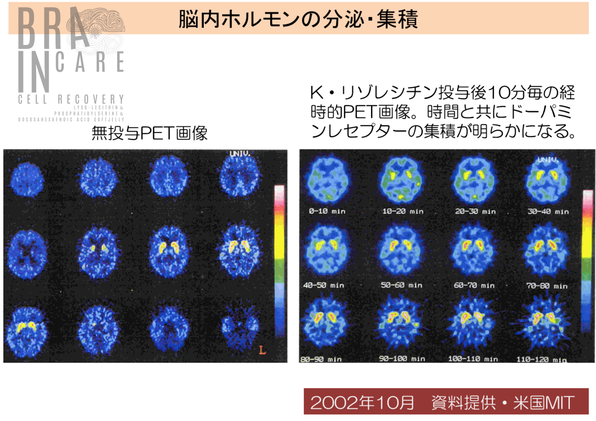 時短脳サプリ  【Brain Care 〈ブレイン ケア〉】 ※ついに発売！ 「あなたの脳に、最高の休息と、極上の栄養を」  生ゼリーで続けやすさ抜群！　