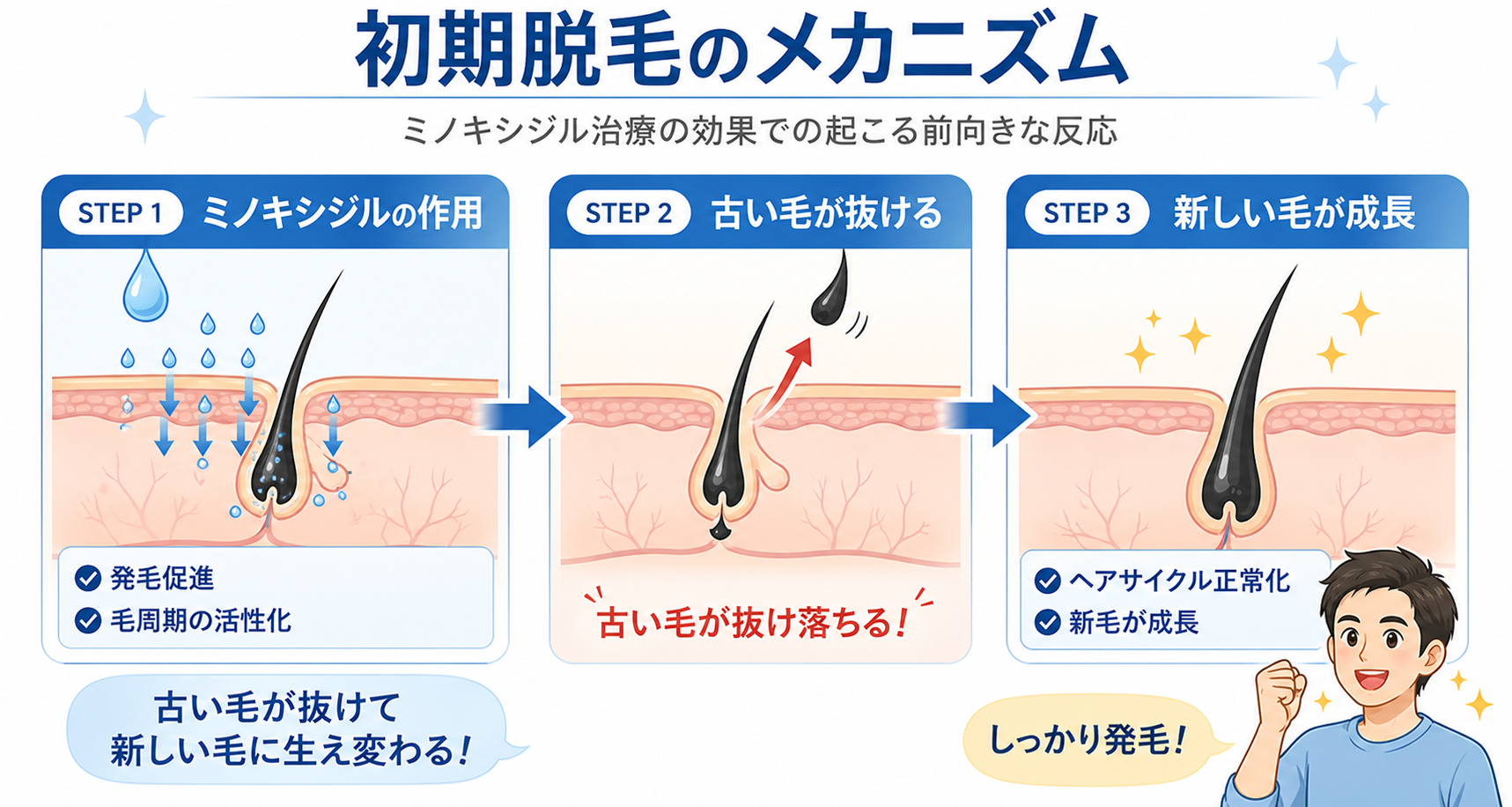 初期脱毛のメカニズム3ステップ図解
