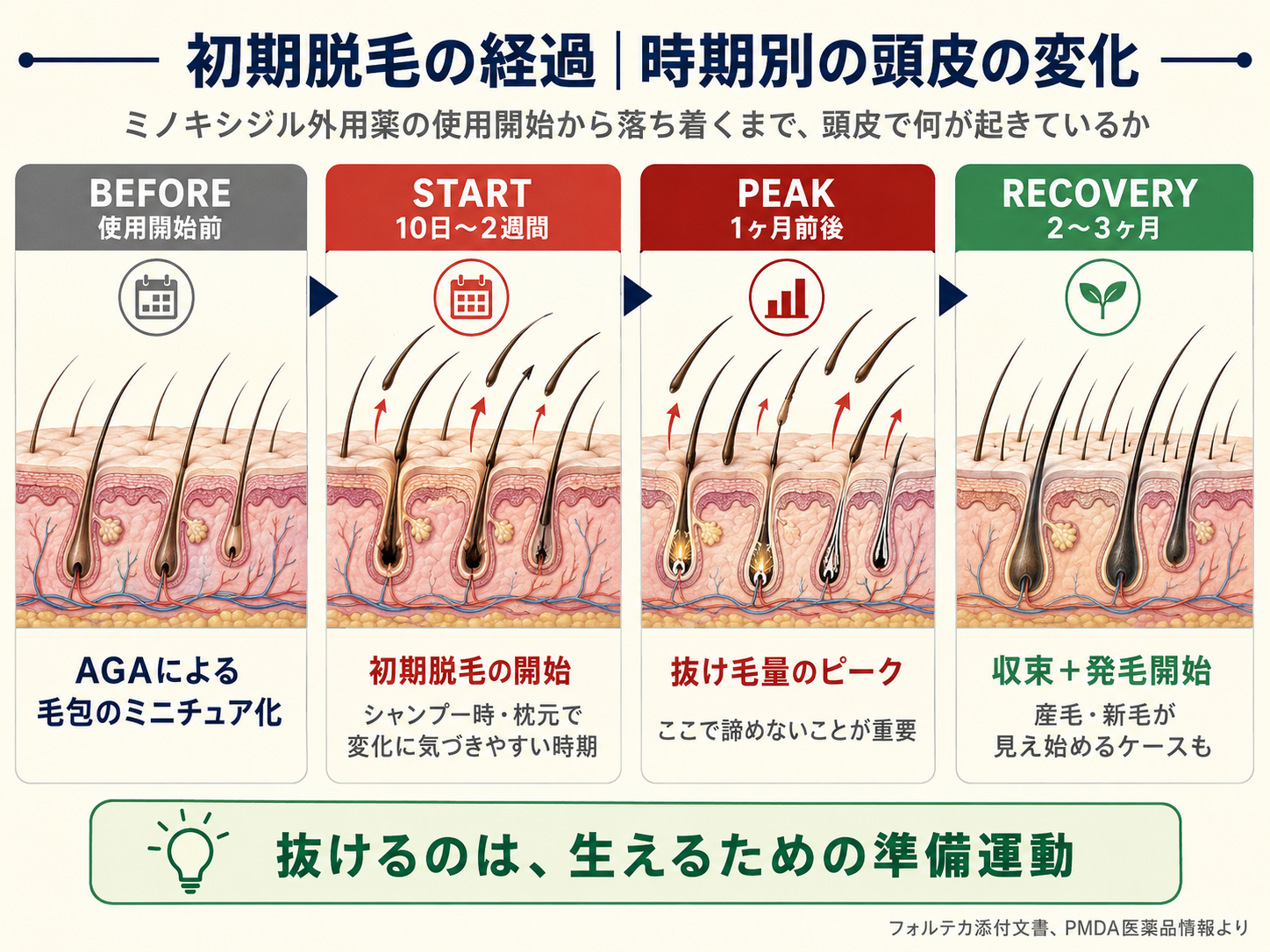 初期脱毛のタイムライン図